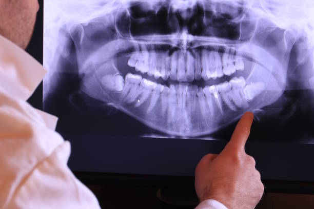 Best Urgent Care for Lost Fillings or Crowns in Delhi Hills, OH